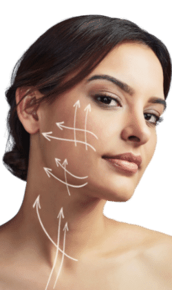 HIFU Lipo 360 Basingstoke 