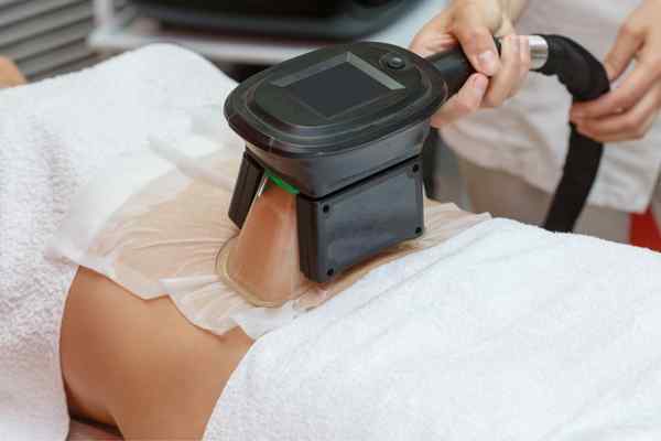 Areas of the Body we treat Cryolipolysis Basingstoke 
