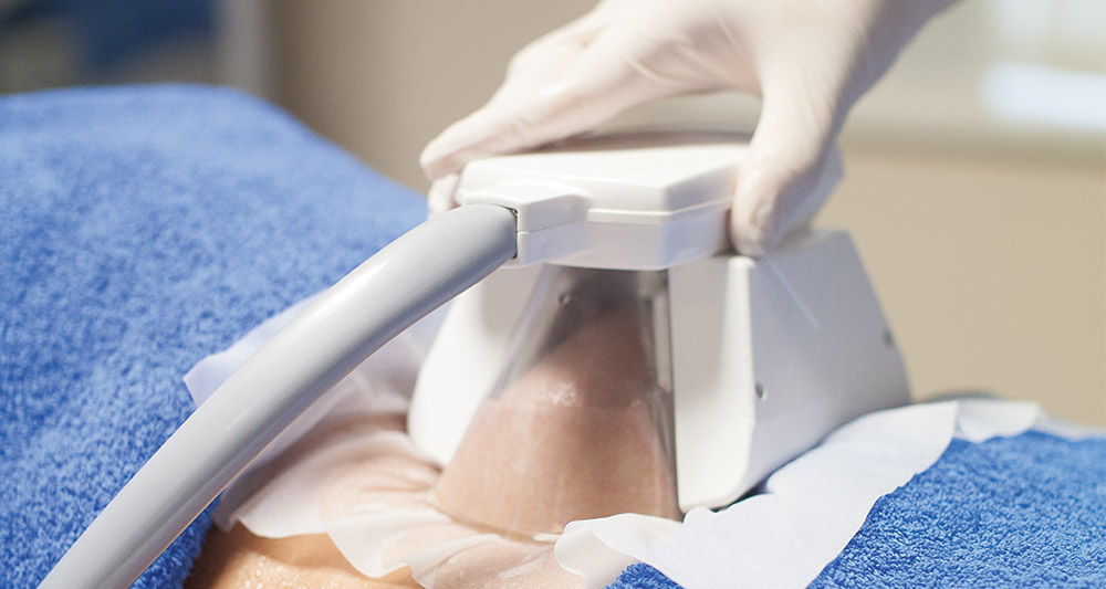 Multiple Areas in One Session HIFU and Fat Freezing Basingstoke 