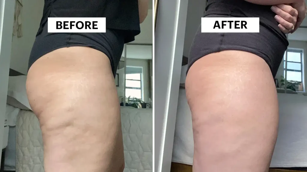 Do Toning Exercise Basingstoke  Really Tackle Cellulite?