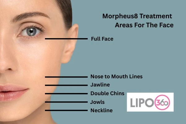 Morpheus8 Basingstoke  Anti ageing treatment! Book in today!