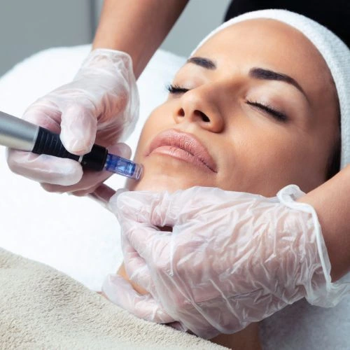 Targeted wrinkle and fine line treatment with Morpheus8 Basingstoke  Book in NOW!