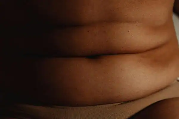image of what stress can do on the stomach area and how Lipo 360 Basingstoke  can help to change your body shape.
