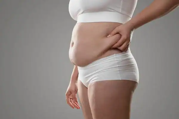 Image of stress belly Basingstoke  How Lipo 360 can help manage your symptoms