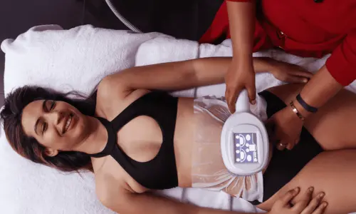 Woman having Body Sculpting treatment post injury Basingstoke 
