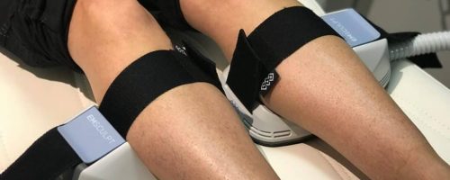 LIPO360 Body Sculpt Areas We Treat Basingstoke  Calves (Lower Legs)